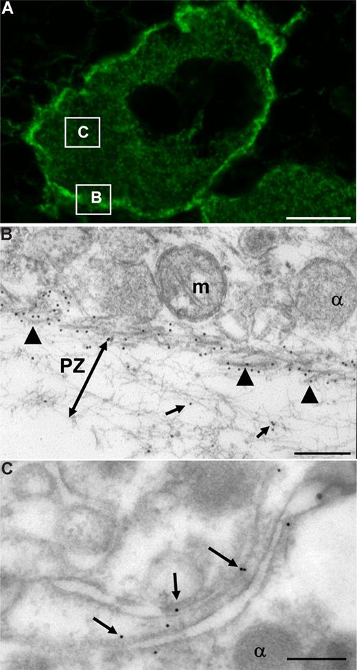 Figure 3. Concentration of myosin IIA at the cell periphery and in contact with the DMS in WT megakaryocytes. (A) Sections of WT mouse femora stained with anti–myosin IIA followed by goat anti–rabbit AF488 antibodies were examined by confocal microscopy. Myosin is present throughout the cytoplasm with a high concentration at the cell periphery. Bar represents 5 μm. (B) Saponin-permeabilized megakaryocytes were incubated with an anti–myosin IIA antibody followed by 10 nm gold-conjugated protein A. After epon embedding, sections were cut and examined by TEM. Myosin IIA is organized in thick filaments at the base of the peripheral zone (PZ) (▲). m indicates mitochondria; α, alpha granule. Bar represents 200 nm. (C) Immunogold labeling of sections of Lowicryl-embedded megakaryocytes. Myosin IIA is in contact with the DMS (). Bar represents 200 nm.