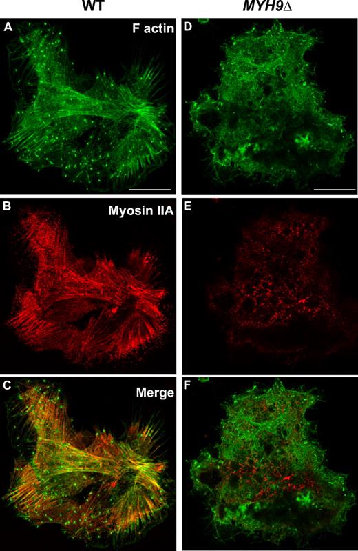 Figure 4. Defective actin reorganization in MYH9Δ megakaryocytes following adhesion to collagen. WT (A-C) and MYH9Δ (D-F) megakaryocytes were allowed to adhere to collagen for 3 hours. (A,D) Actin filaments were visualized by phalloidin-AF488 labeling (green). (B,E) Myosin was stained with an anti–myosin IIA antibody followed by goat anti–rabbit AF555 antibodies (red). (C,F) Merged images. No stress fibers are seen in MYH9Δ cells despite the presence of actin filaments. Images are representative of 3 experiments. Bars equal 25 μm.