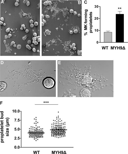 Figure 5. Abnormal proplatelet formation in cultured bone marrow–derived MYH9Δ megakaryocytes. WT (A,D) and MYH9Δ (B,E) megakaryocytes after 4 days of culture as observed by scanning electron microscopy (SEM) (A,B) and DIC microscopy (D,E). (C) Quantification by DIC microscopy of the number of megakaryocytes (MKs) extending proplatelets after 4 days of culture. The proportion of megakaryocytes forming proplatelets is increased in MYH9Δ cells. Data are expressed as the percentage of cells extending proplatelets and are the mean of 3 independent experiments. **P < .01 using the Student t test. (F) Measurement of the proplatelet buds in WT and MYH9Δ megakaryocytes forming proplatelets from 3 independent cultures. The size of the proplatelet buds is significantly increased in MYH9Δ cells. ***P < .001, unpaired Student t test.