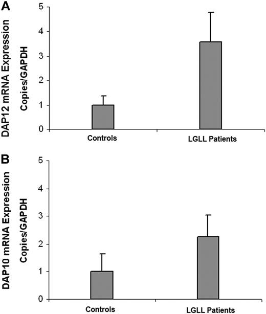 Figure 5. CD8+ T cells from LGLL patients display elevated levels of DAP10 and DAP12. Quantitative RT-PCR was used to determine the relative levels of (A) DAP12 and (B) DAP10 expression in CD8+ T cells from 5 LGLL patients compared with healthy donors (controls). The mean and SEM of 5 healthy donors and LGLL patients are shown.