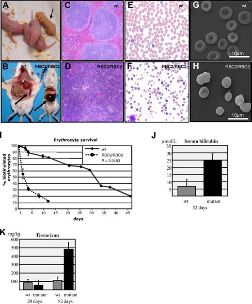 Figure 1. Identification and characterization of RBC2 mice. (A) Jaundiced postnatal day 1 RBC2/RBC2 pup (→) and littermate controls from an RBC2/+ × RBC2/+ mating. (B) Massive splenomegaly in an RBC2/RBC2 animal. (C,D) Splenic histology from wild-type (wt) and RBC2/RBC2 mice. (E,F) Peripheral blood smears from wt and RBC2/RBC2 mice. (G,H) SEM of erythrocytes from wt and RBC2/RBC2 mice. (I) In vivo red cell survival study in wt and RBC2/RBC2 mice. The P value was determined using analysis of variance (ANOVA), and less than .05 was considered significant. (J) Serum bilirubin measured at 52 days in 4 wild-type and 4 RBC2/RBC2 animals. Student t test (P = .023). (K) Liver iron measured at 29 and 52 days in 4 wild-type and 4 RBC2/RBC2 animals. Error bars represent SD in all figures. Student t tests were performed: 29 days measurement (P = .045); and for the 52 day dataset (P = 1.05 × 10−5). P values less than .05 were considered significant.