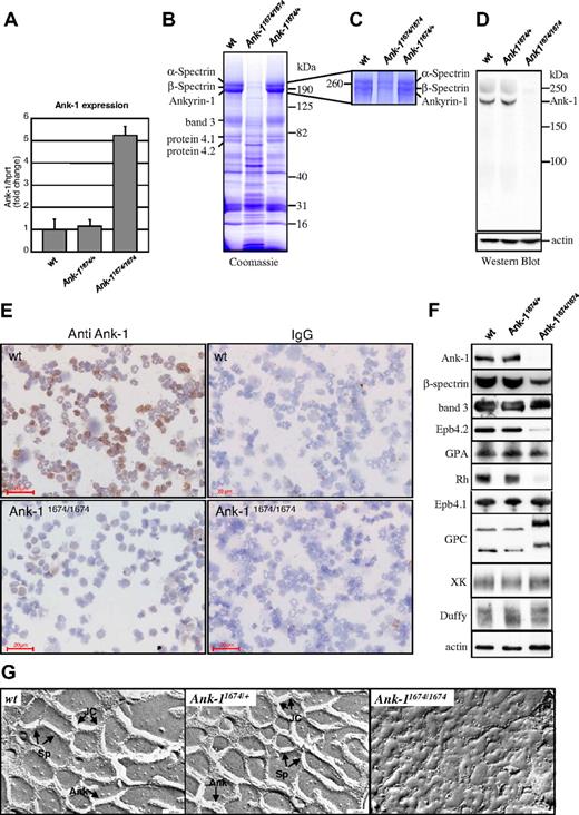 Figure 3. Ank-11674/1674 are null mutants exhibiting severe RBC membrane abnormalities. (A) Quantitative RT-PCR measurement of Ank-1 mRNA levels in 6-week-old wild-type (wt), Ank-11674/+, and Ank-11674/1674 mice. Error bars represent SD. Student t test P values between wt and Ank-11674/1674 were significant (P < .05) and not significant (P > .05) between wt and Ank-11674/+. (B) Coomassie blue–stained SDS polyacrylamide gradient gel (4%-20%), and (C) 5% SDS polyacrylamide gel of membrane ghosts from wt, Ank-11674/+, and Ank-11674/1674 mice. (D) Immunoblot of transmembrane proteins in red cells of wt, Ank-11674/+, and Ank-11674/1674 mice probed with anti–Ank-1 and anti-actin antibodies. (E) Immunostaining of adult bone marrow cytospins from wt, Ank-11674/1674 mice with anti–ANK-1 antibodies, and an IgG control. (F) Immunoblot of transmembrane proteins in red cells of wt, Ank-11674/+, and Ank-11674/1674 mice probed with antibodies against the indicated proteins. (G) Freeze-fracture EM images of red cell membrane skeletons from wt, Ank-11674/+, and Ank-11674/1674 mice. JC indicates junctional complexes; Sp, spectrin tetramers; and Ank, ankyrin.