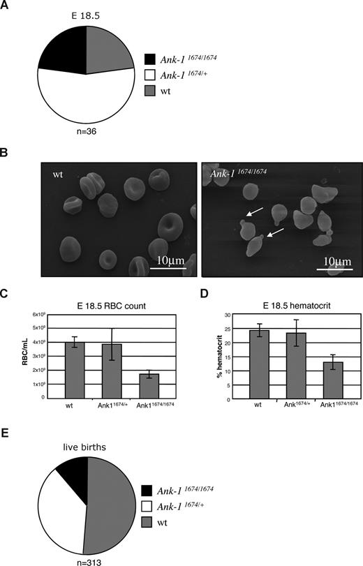 Figure 4. Defective erythropoiesis in Ank-11674/1674 E18.5 embryos. (A) Genotype distribution of wt, Ank-11674/+, and Ank-11674/1674 mice at E18.5. (B) SEM of RBC from wt and Ank-11674/1674 embryos at E18.5. (C,D) RBC and hematocrit in wt, Ank-11674/+, and Ank-11674/1674 embryos at E18.5. Student t tests were performed: the RBC count P value between wt and Ank-11674/+ (P = .34); and between wt and Ank-11674/1674 (P = .009). P values for the hematocrit between wt and Ank-11674/+ (P = .406); and between wt and Ank-11674/1674 (P = .028). P values less than .05 were considered significant. (E) Genotype distribution of live wt, Ank-11674/+ and Ank-11674/1674 mice at birth. Error bars represent SD in all figures.