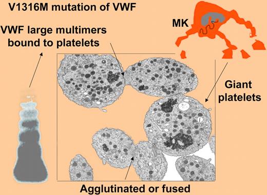 Platelet agglutination and giant platelets, as shown by electron microscopy for a French patient with the V1316M mutation of VWF. These abnormally large platelets suggests that abnormal VWF may impact platelet production from megakaryocytes (MK).