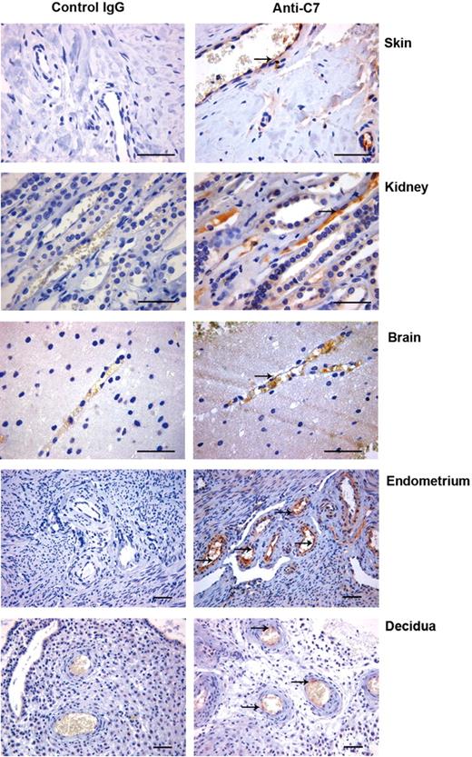Figure 2. Expression of C7 on ECs of blood vessels in various tissues. Sections of paraffin-embedded human skin, kidney, brain, endometrium, and decidua were stained for C7 using goat IgG anti–human C7 or control IgG. Bound antibodies were revealed with the LSAB+ horseradish peroxidase (HRP) kit and 3-amino-9-ethylcarbazole (AEC) as chromogen. The sections were counterstained with hematoxylin. Magnification bar represents 30 μm.