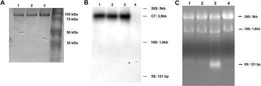 Figure 3. Characterization of mC7. (A) Western blot analysis of affinity-purified C7 from human normal serum (track 1), from cell supernatant (track 2), or from cell lysate (track 3). (B) Northern blot analysis of mRNA purified from 2 preparations of HUVECs (track 1 and 2), HepG2 (positive control; track 3), and Raji cells (negative control; track 4). (C) Ethidium bromide image of 2 preparations of HUVECs (track 1 and 2), HepG2 (track 3), and Raji cells (track 4). One of 3 experiments with similar results is shown.
