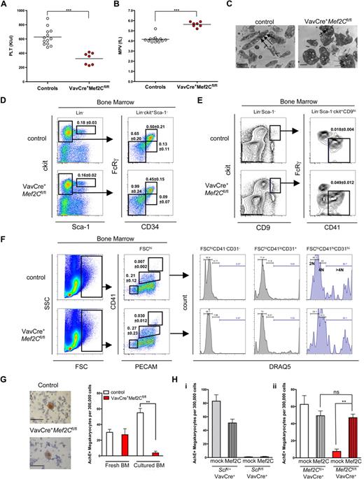 Figure 4. Deletion of Mef2C in the hematopoietic system reveals a requirement of Mef2C for proper megakaryocyte/platelet development. (A,B) CBC analysis of peripheral blood showed that VavCre+Mef2Cfl/fl mice exhibit marked thrombocytopenia and increased platelet size. Circles indicate analysis of individual mice. PLT indicates platelet count; MPV, mean platelet volume. ***P < .001. (C) Electron microscopy imaging of platelets reveals severe ultrastructural defects of Mef2C-deficient platelets, including enlarged size and loss of elongated form. In addition, Mef2C-deficient platelets demonstrated a loss of α-granules (→) and an increase in depleted granules (dashed arrows). (Images were captured on a Gatan UltraScan 2k*2k camera, developed and scanned at 1200 dpi. Magnification was ×10 000.) Scale bar represents 1 μm. (D) FACS analysis of the HSC/progenitor compartment shows that Mef2C-deficient mice maintain normal phenotypic frequency of HSCs (Lin−Sca-1hickithi), and CMP and granulocyte macrophage (GMP) progenitors. A slight increase in the frequency of myelo-erythroid progenitors (MEP) was observed. (E) FACS analysis documents a slight increase of committed unilineage megakaryocytic progenitors (CFU-Mk) in Mef2C-deficient mice. (F) Analysis of the megakaryocyte compartment revealed comparable frequency of immature megakaryocytes (FSChiCD41loCD31+) and a slight increase in the frequency of mature megakaryocytes (FSChiCD41+CD31+) in Mef2C-deficient mice. Assessment of ploidy using DRAQ5 showed that Mef2C-deficient immature and mature megakaryocytes are capable of endomitosis (> 4N). FSChiCD41−CD31− cells are shown as 2N controls. (G) AchE staining of bone marrow cytospins documents the presence of AchE+ megakaryocytes in the bone marrow of Mef2C-deficient mice. (Sections were analyzed on a Zeiss Axiovert 40 CFL microscope. Images were captured using a Canon PC1089. Magnification, ×20.) However, after in vitro culture, VavCre+Mef2Cfl/fl bone marrow (BM) progenitors displayed a significantly impaired ability to generate AchE+ megakaryocytes compared with controls. Bars represent mean plus or minus SD; N = 3. (H) AchE staining of in vitro bone marrow cultures with (Mef2C) or without (mock) transduction with Mef2C retroviral vector shows that Mef2C does not rescue megakaryopoiesis in VavCre+ Sclfl/fl bone marrow cultures (i), whereas it does rescue megakaryopoiesis in VavCre+ Mef2Cfl/fl bone marrow (ii). Bars indicate mean plus or minus SD, n = 4 to 6. **P < .01. ns indicates not significant.