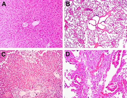Figure 3. Lack of donor IFN-γ results in increased pathologic GVHD in sublethally irradiated allo-HCT recipients. B6D2F1 mice received 6 Gy TBI followed the next day by administration of 3 × 107 splenocytes alone or along with 107 BMCs from WT or GKO B6 donors. Carcasses were preserved in formalin after death, and GVHD target tissues were prepared for pathologic examination (findings are summarized in Table 1). Liver (A) and lung (B) sections (hematoxylin and eosin; original magnification ×200) from a recipient of WT B6 splenocytes alone that died at day 14. Liver (C) and lung (D) sections (hematoxylin and eosin; original magnification ×200) from a recipient of GKO B6 splenocytes alone that died at day 17.