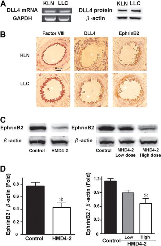 Figure 3. Expression of DLL4 and ephrinB2 in KLN205 and LLC tumors. (A) Expression of DLL4 in subcutaneous KLN205 and LLC tumors was detected by RT-PCR (left) and Western blotting (right). (B) Representative immunohistochemical staining of factor VIII–related antigen, DLL4, and ephrinB2. Data were obtained from serial sections of the same area in both KLN205 and LLC tumors. (C) Western blotting of ephrinB2 in KLN205 (left) and LLC (right) tumors. (D) The relative expression of ephrinB2 was measured by densitometric analysis in KLN205 tumors (left) and LLC tumors (right). The results are expressed as the ratio of the amount of ephrinB2 protein to the amount of β-actin. Data are mean plus or minus SE (n = 7 per group). *P < .05 versus control by Student unpaired t test (left) or 1-way ANOVA with Fisher least-significant-difference test (right).