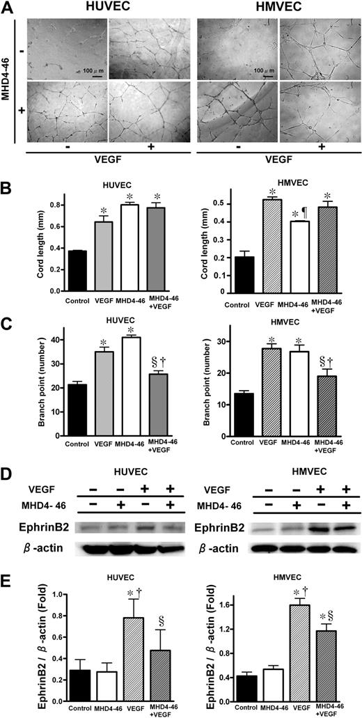 Figure 5. DLL4 blockade increased cord length, but decreased branch point number and suppressed VEGF-induced ephrinB2 expression. (A) Effect of MHD4-46 on HUVEC and HMEVC tubular formation. Representative microphotographs at ×100 magnification from triplicate wells of experiments repeated twice are shown. (B,C) Quantitative data of cord length (B) and brunch point number (C). (D) Protein expression of ephrinB2 and β-action in HUVECs and HMVECs. (E) The relative expression of ephrinB2 to β-action was measured by densitometric analysis. Data are shown as mean plus or minus SE of triplicate wells from the representative result of 3 independent experiments. *P < .05 versus control, §P < .05 versus VEGF, †P < .05 versus MHD4-46 by 1-way ANOVA with Fisher least-significant-difference test.