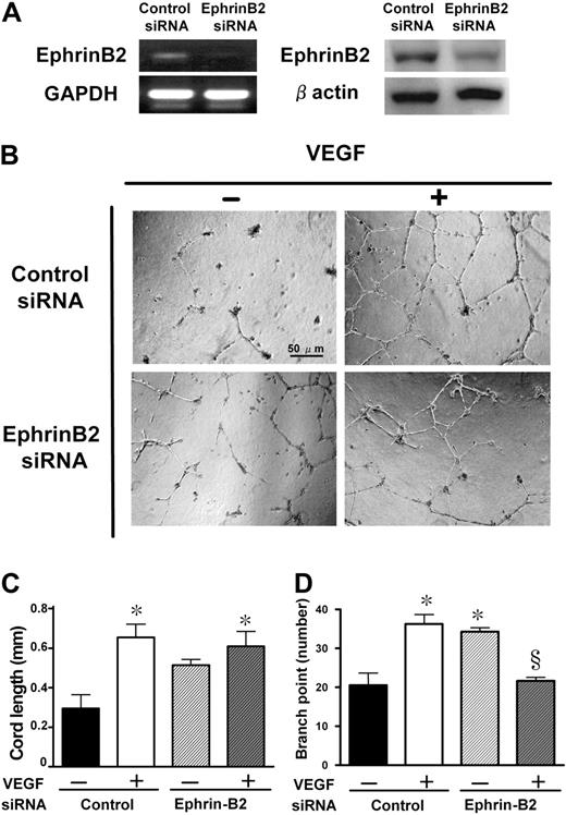 Figure 6. Knockdown of ephrinB2 with siRNA and its effects on in vitro tubular formation. (A) Knockdown of ephrinB2 in HUVECs was evaluated both at mRNA and protein levels. The reduction rates in fold expression (ephrinB2 siRNA/control siRNA) of mRNA and protein levels were approximately 27% and 60%, respectively. (B) Effect of ephrinB2 knockdown on HUVEC tubular formation. Representative microphotographs at ×100 magnification from triplicate wells of 2 repeated experiments are shown. Quantitative data of cord length (C) and branch point number (D). Data are shown as mean plus or minus SE of triplicate wells in 2 experiments. *P < .05 versus control siRNA without VEGF and §P < .05 versus control siRNA with VEGF by 1-way ANOVA with Fisher least-significant-difference test.