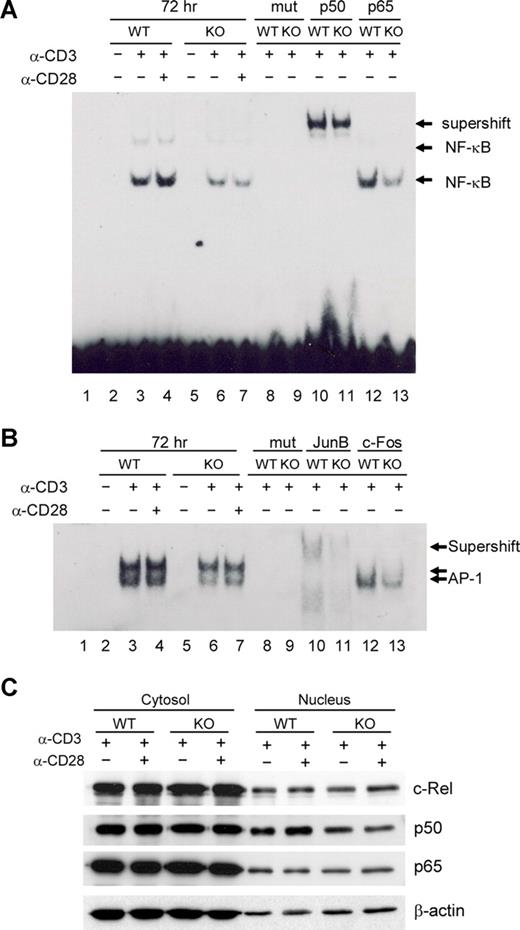 Figure 6. Defects in NF-κB and AP-1 activity in viperin−/− CD4+ T cells. (A,B) EMSA analysis of NF-κB (A) and AP-1 (B) activity in nuclear extracts from unstimulated or stimulated CD4+ T cells for 72 hours. The supershift assays were performed with indicated antibodies. Lane 1 was probe-only control without lysates. Lanes 8 and 9: mutant probes (mut) were used to replace specific probes in binding reactions to verify the specificity of probes. (C) Immunoblotting analysis for NF-κB subunits in CD4+ T cells stimulated with anti-CD3/CD28 for 72 hours. Results are representative of 3 independent experiments.