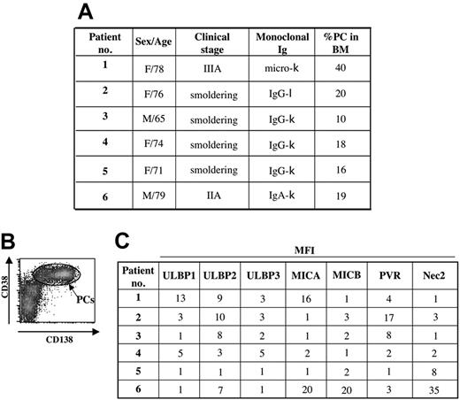 Figure 3. Patient characteristics. (A) Patients were classified according to Durie and Salmon's staging system. (B) Malignant PCs obtained from BM samples of MM patients were selected by gating on CD38+CD138+ cells and an example is shown (P2). (C) NKG2D and DNAM-1 ligand expression was evaluated on malignant PCs from BM sample by gating on the CD38+CD138+ population. The mean fluorescence intensity (MFI) of each specific ligand subtracted from the MFI of isotype control antibody is reported.