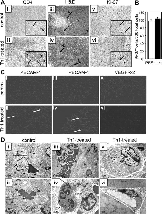 Figure 6. Immunohistochemical analysis and EM of tumors. Serial sections of representative tumors (n = 8) of Th1 cell–treated and control mice from day 18. (A) Tumors were stained with monoclonal anti-CD4 antibody (i,ii) showing a strong increase in CD4+ cells in tumors of Th1 cell–treated mice. indicates CD4+ cells. Staining with H&E (iii,iv) showed no major differences in the morphology of the tumors. Necrosis (N) was detected in tumors of Th1 cell–treated and PBS-treated mice. Ki-67 staining (v,vi) showed no obvious differences in the proliferation rate of the tumors. indicates Ki-67–positive cells. Pictures, ×100 magnification. Inlays, ×200 original magnification. (B) Quantitative analysis of (Av,vi). Ki-67+ cells of 500 total cells in tumor sections (n = 60) of Th1 cell–treated and PBS-treated mice were counted. Error bars denote SEM. (C) Tumors were stained with monoclonal anti–PECAM-1 antibody (i-iv) showing homogenous vascularization in both groups. However, minor changes in vessel morphology (white arrows) and a minor decrease of tumor vessel density were detectable in tumors of Th1 cell–treated mice (ii,iv) compared with control mice (i,iii). Staining of tumors with monoclonal anti–VEGFR-2 antibody (v,vi) revealed no obvious change in the receptor expression pattern between both groups. Pictures, ×200 original magnification. (D) EM of blood vessels. (i) Blood vessels with a bulged EC body (E), tight junctions (), and the basal lamina (labeled with *). (ii) Blood lacuna without limiting ECs, but with extracellular matrix–like collagen fibrils (*) that are located between tumor cells and blood cells. (iii) Blood vessel with leukocyte transendothelial migration. (iv) Higher magnification of panel iii, showing a transcellularly transmigrated leukocyte (L) still covered by a basal lamina (). (v) Obliterated vessel. The left arrow labels a tight junction; the right arrow, the rest of the lumen. (vi) Vessels in adjacent muscle of Th1 cell–treated tumors appear normal. In summary, blood vessels of PBS-treated (i,ii) tumors were seen as normal tumor vessels. In contrast, degenerated ECs were observed more frequently in tumors of Th1 cell–treated mice (iii-v). In addition, strong inflammatory processes (iii,iv) and more obliterated vessels (v) were seen in tumors of Th1 cell–treated mice. Experiments were performed as described in “Methods.”