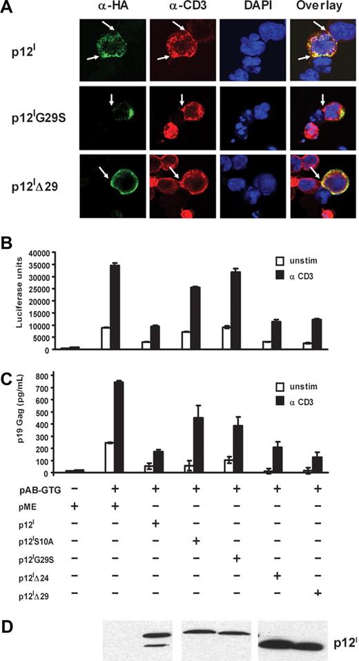Figure 4. The 8-kDa p12I protein down-regulates TCR signaling and is recruited to the immunologic synapse. (A) Jurkat T cells expressing the wild-type p12I, p12IG29S, or p12IΔ29 deletion mutants were cocultivated with SEE prepulsed B cells for 15 minutes. Cells were costained with anti-CD3 and anti-HA antibodies. The arrows indicate the IS found between the B cell and the T cell. (B-D) Jurkat T cells were cotransfected with the p12I knockout proviral clone, pAB-GTG, p12I, the p12I mutants, and the HTLV-LTR–driven luciferase reporter plasmid. Cells were collected 24 hours later, resuspended in fresh media, and stimulated with or without anti-CD3 antibody. Tax-driven luciferase activity (B), p19 Gag production in the supernatant (C), and p12I expression (D) at 48 hours are shown.
