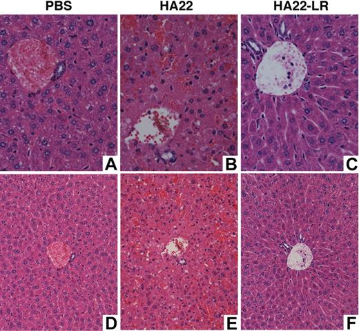 Figure 5. Liver sections. Nude mice were treated intravenously with PBS, 2 mg/kg of HA22, or 20 mg/kg of HA22-LR. After 30 hours, livers were removed, fixed in formalin, sectioned, and stained with hematoxylin and eosin. Panel A (original magnification ×400) and panel D (original magnification ×200) show a representative section of the PBS-treated mouse. Panel B (original magnification ×400) and panel E (original magnification ×200) show a representative section of the HA22-treated mouse. There are many individual necrotic hepatocytes in various stages of cell death as well as the loss of hepatocytes and replacement with blood in sinusoids. Panel C (original magnification ×400) and panel F (original magnification ×200) show a representative section of the HA22-LR-treated mouse. Slides were viewed with an Olympus BX41 microscope. Images were acquired using an Olympus DP41 camera with its own Olympus DP Controller software. Photoshop CS3 was used to produce the composite.