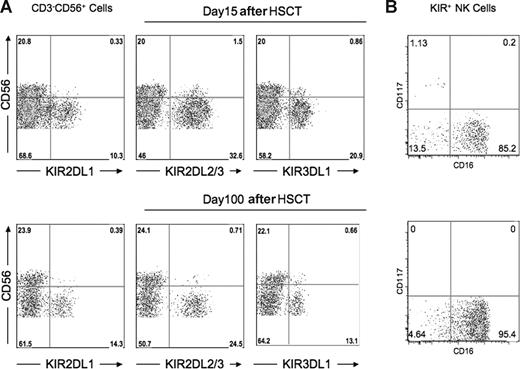 Figure 6. Majority of post-HSCT KIR+ NK cells belong to the CD56dim NK subset. PBMC preparations from the patient at day +15 after HSCT and day +100 after HSCT were stained with monoclonal antibodies specific for CD3, CD56, KIR2DL1, KIR2DL3, KIR3DL1, CD16, and CD117. (A) Flow cytometric staining gated on CD3−CD56+ NK cells demonstrates that the overwhelming majority of KIR+ cells are CD56dim at both time points. Data are representative of analysis from 15 patients. (B) Flow cytometric staining gated on CD3−CD56+ KIR+ cells shows the majority of cells at both time points are CD117−CD16+. Data are representative of analysis from 6 patients.