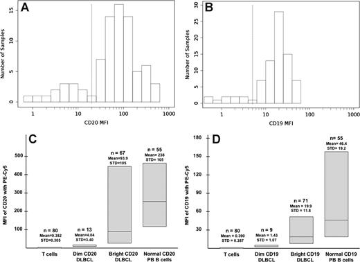 Figure 1. CD20 and CD19 expression in DLBCL by flow cytometry. (A) Distribution of MFI in CD20 expression in the DLBCL samples from 2004 to 2007. (B) Distribution of MFI in CD19 expression in the DLBCL samples from 2004 to 2007. (C) Heterogeneity in CD20 expression in DLBCL and normal peripheral blood lymphocytes from 2004 to 2007. From 2002 to 2004: dim CD20, mean MFI: 2.1; STD: 0.8; range: 0.55-3.91; bright CD20 mean, MFI: 17.6; STD: 19.4; range: 4.13-103. From 1997 to 2002: dim CD20, mean MFI: 1.1; STD: 0.4; range: 0.69-1.92; bright CD20, mean MFI: 14.1; STD: 18.5; range: 2.4-85.1. (D) Heterogeneity in CD19 expression in DLBCL and normal peripheral blood lymphocytes from 2004 to 2007. From 2002 to 2004: dim CD19, mean MFI: 0.44; STD: 0.11; range: 0.27-0.57; bright CD19, mean MFI: 4.79; STD: 4.28; range: 0.6-17.5. From 1997 to 2002: dim CD19, mean MFI: 0.52; STD: 0.22; range: 0.15-0.85; bright CD19, mean MFI: 6.71; STD: 6.70; range: 1.79-36.5. MFI indicates mean fluorescence intensity; DLBCL, diffuse large B-cell lymphoma; STD, standard deviation; PB, peripheral blood.