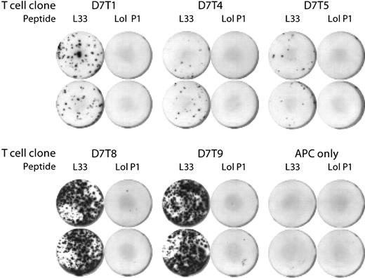 Figure 2. Confirmation of peptide-specificity of isolated CD4+ T-cell clones. Clonal CD4+ T cells were cocultured for 36 hours with 50 000 peptide-pulsed B lymphoblasts and assayed for IFNγ secretion with the ELISPOT assay technique. HPA-1a–derived peptide L33, but not peptide Lol P1, induced IFNγ secretion. Duplicate assays are shown. Two hundred T cells were assayed per well of clones D7T1 and D7T4, and the number of D7T5, D7T8, and D7T9 was not determined. Wells marked “APC only” contained peptide-pulsed B lymphoblasts and no T cells. APC indicates antigen-presenting cell.