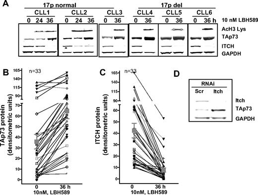 Figure 1. Inverse relation between p73 and Itch in primary CLL consequent to deacetylase inhibition. (A) Primary leukemia cells that were normal or del17p were treated with 10 nM LBH589 for 36 hours. Changes in acetylation levels of histone H3, expression levels of p73, Itch, and GAPDH were measured. (B,C) Quantification and inverse relation between p73 and Itch expression in response to LBH589 in 33 primary leukemia samples. The Pearson correlation between paired samples was conducted (P < .05, 2-tailed P value, Pearson correlation r = −0.4). (D) K562 cells were transfected with short interfering RNA that were scrambled or against Itch for 48 hours, followed by immunoblotting for Itch, p73, and GAPDH.