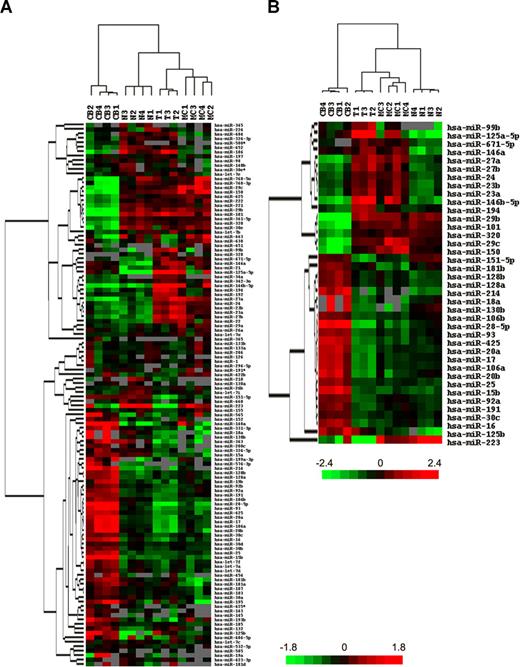 Figure 1. Profiling of miRNA expression in tonsillar subpopulations of lymphocytes by microarray hybridization. (A) Unsupervised hierarchical clustering of tonsillar lymphocyte subpopulations using all miRNAs with no more than 50% missing values. (B) Hierarchical cluster of the same samples performed with the classifier of 39 miRNAs obtained after SAM and PAM analysis. Mean centered log ratios for each miRNA are represented. Missing values are in gray. CB indicates centroblast; MC, memory B cell; N, naive B cell; and T, T cell.