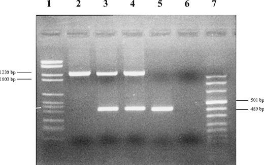 Figure 1. Electrophoresis of PCR products of proband, parents and control. Upper bands correspond to PCR products obtained by using gap-F and gap-R primers designed by Le Gac et al.3 Lower bands correspond to HFE exon 5. Lane 1: DNA molecular marker II; lane 2: proband; lane 3: father; lane 4: mother; lane 5: control; lane 6: negative; and lane 7: DNA molecular marker VIII (Roche Diagnostics, Mannheim, Germany).