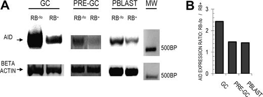 Figure 3. AID expression is reduced among RB+ GC and pre-GC B cells. (A) AID transcripts from RB−/lo and RB+ fractions of GC, pre-GC, and Pblast B-cell subsets were semiquantitatively amplified via RT-PCR. RNA concentrations were normalized using beta actin. The 500–base pair molecular weight marker (MW) is indicated to the right. In each case, AID and RB expression were inversely related. (B) The AID expression ratio between RB−/lo versus RB+ fractions (RB−/lo AID EXPRESSION/RB+ AID EXPRESSION) was determined by comparing digitally quantified band intensities. Each AID band was first normalized to its respective beta actin band (AID intensity/beta actin intensity = AIDNORM). RB−/lo versus RB+ AID expression ratios were next calculated as (RB−/lo AIDNORM/RB+ AIDNORM). In the case of GC B cells, AID expression is 2.4-fold greater among the RB−/lo fraction (relative to the RB+ counterpart).