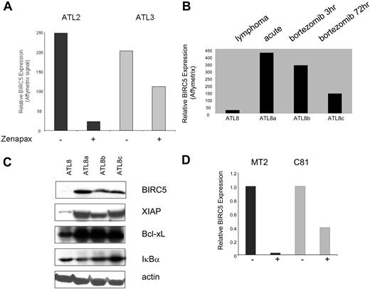 Figure 6. BIRC5 expression after drug treatment. (A) Graph comparing the relative expression of BIRC5 in ATL2 and ATL3 before and after (−, +) Zenapax (humanized anti–IL-2Rα) treatment. (B) Expression of BIRC5 in PBLs in lymphoma (ATL8), acute stage (ATL8a), and 3 and 72 hours (ATL8b and 8c) after bortezomib treatment (1.3 mg/m2 twice weekly for 2 weeks). (C) The level of expression of antiapoptotic proteins BIRC5 (Abcam), XIAP (Cell Signaling Technology, Danvers, MA), and Bcl-xL (Cell Signaling Technology) were examined by Western blot analysis in whole-cell extracts (50 μg) from ATL patient 8. Actin levels were determined as a loading control. Also shown are the levels of IκBα (EMD Chemicals, Gibbstown, NJ). (D) Total RNA from untreated (−) or treated (+) cells with 10 nM bortezomib was analyzed on Apoptosis GEarrays (Superarray Bioscience). BIRC5 expression in untreated samples was set at 1.