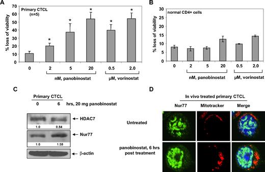 Figure 7. Panobinostat induces expression and mitochondrial localization of Nur77, as well as induces loss of viability of primary CTCL cells. (A) Bone marrow– or peripheral blood–derived CD4+ primary CTCL cells from 5 patients with advanced CTCL were treated with the indicated concentrations of panobinostat or vorinostat for 48 hours. Then, the percentages of nonviable cells were determined by trypan blue dye uptake in a hemocytometer. Values represent the percentage of nonviable cell from each condition compared with untreated cells. * denotes values significantly different from that of untreated controls (P < .05). (B) Normal CD4+ cells from peripheral blood were treated with the indicated concentrations of panobinostat or vorinostat for 48 hours. Following this, the percentages of nonviable cells were determined by trypan blue dye uptake in a hemocytometer. Values represent the percentage of nonviable cells from each condition compared with untreated cells. (C) Total cell lysates from CD4+ cells harvested from the peripheral blood of a CTCL patient undergoing panobinostat treatment were prepared and immunoblot analysis was done for HDAC7 and Nur77. The levels of β-actin in the lysates served as the loading control. (D) Primary CTCL cells were harvested from a patient undergoing panobinostat treatment at the indicated times. Cells were incubated with MitoTracker for 30 minutes, cytospun, and stained with Nur77. Images were acquired with a Zeiss LSM510 meta confocal microscope equipped with a 63×/1.2 NA water immersion–objective lens.