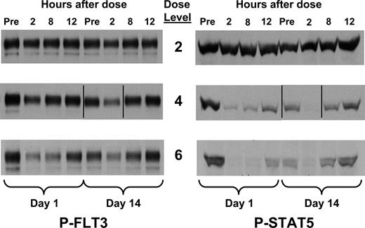 Figure 4. PIA results for patients receiving KW-2449. Plasma was isolated from whole-blood samples obtained from patients receiving increasing doses of KW-2449 on the clinical trial. Samples were obtained immediately prior to dosing, and at 2, 8, and 12 hours after dosing on days 1 and 14 of cycle 1. Dose levels 2, 4, and 6 correspond to total daily doses of 50, 200, and 400 mg, respectively (Table 1). Shown are the results from 3 representative patients on successively higher dose levels using the PIA assay for phosphorylated FLT3 (left) and STAT5 (right). Vertical lines have been inserted to indicate a repositioned gel lane.