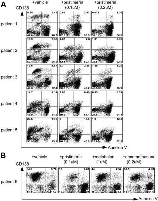 Figure 5. Pristimerin is selectively cytotoxic to primary myeloma cells in mixed-lineage bone marrow cultures from myeloma patients. Flow cytometric analyses of primary bone marrow samples, obtained from multiple myeloma patients, for viability or apoptosis (annexin V binding, horizontal axis) of CD138+ (myeloma) and CD138− (hematopoietic progenitor) fractions (vertical axis), after in vitro drug exposure and culture. (A) Examples of 5 myeloma patient bone marrow samples, each treated separately with either vehicle (left column), pristimerin 100 nM (middle), or pristimerin 200 nM (right column) for 72 hours, showing preferential killing of CD138+ tumor cells by pristimerin. Pristimerin induces preferential loss of viable primary tumor cells (top left quadrants, CD138+, annexin V−) and accumulation of CD138− annexin V+ cells (bottom right quadrants). Following induction of apoptosis, myeloma cells shed surface CD138 to become annexin V+, CD138−,35 and are detected in the right bottom quadrant. (B) Response of primary bone marrow cells from a patient with advanced myeloma to pristimerin 100 nM, dexamethasone 200 nM, or melphalan 1 μM, demonstrating potent selective antimyeloma in vitro efficacy of pristimerin compared with standard antimyeloma agents.