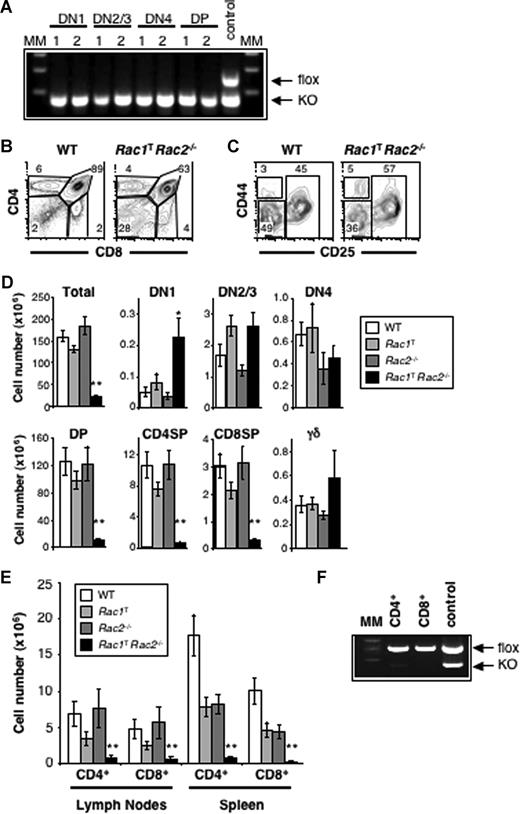 Figure 1. Impaired T-cell development in the absence of Rac1 and Rac2. (A) Gel electrophoretic analysis showing PCR products diagnostic for the Rac1flox (flox) and Rac1− (KO) alleles amplified from DNA extracted from the indicated sorted thymocyte subsets (DN1, DN2/3, DN4, and DP) from 2 individual Rac1TRac2−/− mice (lanes 1,2) and, as a control for efficient amplification, from total thymocytes from a Rac1flox/−Rac2−/− (control) mouse that did not carry the hCD2-iCre transgene. (B) Flow cytometric analysis of CD4 and CD8 expression on thymocytes from Rac1+/+Rac2+/+hCD2-iCre (WT) and Rac1flox/floxRac2−/−hCD2-iCre (Rac1TRac2−/−) mice. Gates identify CD4−CD8− double-negative (DN), CD4+CD8+ double-positive (DP), and CD4+CD8− and CD4−CD8+ single-positive (CD4SP and CD8SP) cells. Numbers indicate percentage of cells falling into the gates. (C) Flow cytometric analysis of CD44 and CD25 expression on thymocytes from WT and Rac1TRac2−/− mice, which were Thy1+ but negative for expression of the lineage (Lin) markers (CD4, CD8, CD3ϵ, TCRβ, TCRγδ, B220, Gr1, Mac1, Dx5; not shown). Gates show DN1 (CD44+CD25−), DN2 and DN3 (DN2/3, CD44+/−CD25+), and DN4 (CD44−CD25−) populations. Numbers indicate percentage of cells falling into the gates. (D) Graphs showing mean (± SEM) total thymocyte cell numbers or numbers of cells in populations gated as in panels B and C. Also shown are the number of thymocytes expressing TCRγδ (γδ). Thymocytes were analyzed from WT, Rac1flox/floxRac2+/+hCD2-iCre (Rac1T), Rac1+/+Rac2−/−hCD2-iCre (Rac2−/−), and Rac1TRac2−/− mice. (E) Graph showing mean (± SEM) CD4+ or CD8+ T-cell numbers in the lymph nodes and spleen of mice of the indicated genotypes. (F) Gel electrophoretic analysis showing PCR products diagnostic for the Rac1flox (flox) and Rac1− (KO) alleles amplified from DNA extracted from CD4+ or CD8+ T cells isolated from the lymph nodes of Rac1TRac2−/− mice, or from tail DNA of a control Rac1flox/−Rac2−/− mouse that did not carry the hCD2-iCre transgene. MM indicates molecular weight markers. Statistically significant differences between WT and Rac1TRac2−/− mice are indicated (*P < .01; **P < .001).