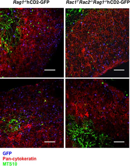 Figure 5. Absence of Rac1 and Rac2 does not impair localization of DN thymocytes. Fluorescence images of thymic sections from mixed radiation chimeras reconstituted with bone marrow from either Rac1+/+Rac2+/+Rag1−/−hCD2-iCre/hCD2-GFP (Rag1−/−hCD2-GFP) or Rac1flox/floxRac2−/−Rag1−/−hCD2-iCre/hCD2-GFP (Rac1TRac2−/−Rag1−/−hCD2-GFP) mice and bone marrow from C57BL/6 mice. Two images are shown for each genotype. Sections were stained with anti-GFP (blue) to identify the DN2/3 thymocytes from the hCD2-GFP–containing strains, anti–pan-cytokeratin (red) to recognize cortical epithelial cells, and MTS10 (green) to identify medullary epithelial cells. Note that GFP+ cells are distributed throughout the cortex in both strains. Bar indicates 145 μm.