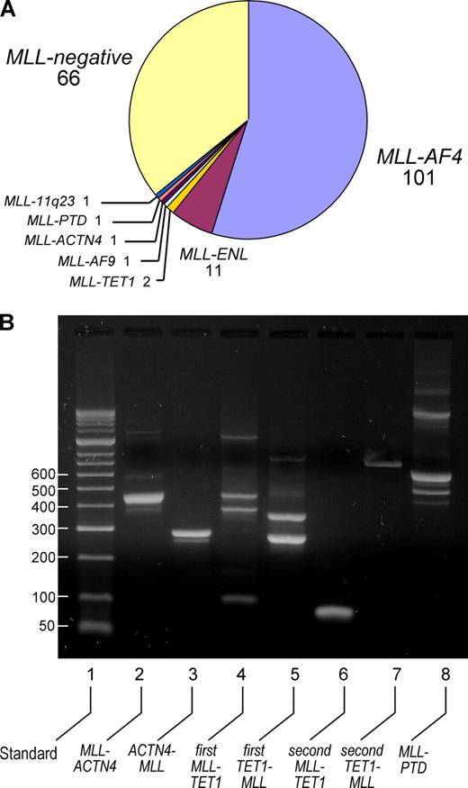 Figure 1. The MLL recombinome of adult CD10− BCP ALL. (A) The diagram shows the distribution of MLL fusion genes in 184 adult CD10− BCP ALL patients. (B) The agarose gel shows transcripts arising from rare MLL fusions. One patient had an MLL-ACTN4 fusion, 2 others an MLL-TET1 fusion. In the first MLL-TET1–positive patient, additional bands were visible, caused by the splicing of 90-bp TET1 exon 9 and a cryptic 87-bp exon in TET1 intron 8. In all 3 patients, the reciprocal transcript was also detectable.