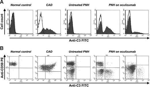 Figure 1. C3 coating on RBCs by flow cytometry. (A) Single-color flow cytometry. (y-axis) Cell count; (x-axis) FITC-conjugated anti-C3 polyclonal antibody (logarithm of fluorescence). Each filled histogram represents a single case, with the corresponding isotypic control (empty histogram). CAD indicates cold agglutinin disease (positive control). In the PNH patients, a discrete population of RBCs coated by C3 appears under eculizumab treatment. (B) Double-color flow cytometry. (y-axis) PE-conjugated anti-CD59 monoclonal antibody (logarithm of fluorescence); (x-axis) FITC-conjugated anti-C3 polyclonal antibody (logarithm of fluorescence). Each dot plot represents a single case. The typical bimodal pattern (CD59+ and CD59−) of untreated PNH patient becomes trimodal under eculizumab treatment for the presence of CD59−/C3+ RBCs.