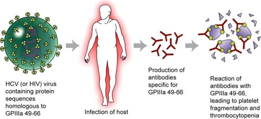 HCV (and HIV) contain proteins with peptide sequences homologous to GPIIIa49-66. Infection with either (or both) of these viruses leads to presentation of these peptides to the host immune system and production of antibodies specific for GPIIIa49-66 by some individuals. The antibodies react with GPIIIa on autologous platelets, leading to platelet fragmentation and thrombocytopenia. Defective immune surveillance associated with HIV infection may explain breakage of immune tolerance to the autologous peptides. Professional illustration by Kenneth X. Probst.