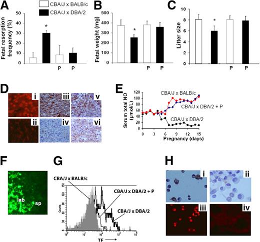 Figure 4. Pravastatin prevents pregnancy loss in CBA/J × DBA/2 mice. (A,B) CBA/J × DBA/2 and CBA/J × BALB/c mice were treated with pravastatin (P) (n = 5-7). Mice were killed on day 15 of pregnancy, uteri were dissected, and fetal resorption frequency was calculated. (A) Treatment with P prevented fetal loss (*P < .005, CBA/J × DBA/2 versus CBA/J × DBA/2 plus P). (B) P also prevented IUGR in CBA/J × DBA/2 mice (*P < .01, CBA/J × DBA/2 versus CBA/J × DBA/2 plus P). (C) Litter size at birth. P increased the litter size in CBA/J × DBA/2 mice. (D) Superoxide generation, and TF and fibrin staining in day-15 placentas. Increased free radical–mediated lipid peroxidation was observed in placentas from CBA/J × DBA/2 mice (i). No signs of oxidative damage were observed in placentas of CBA/J × DBA/2 mice that received P (ii). Extensive TF (iii) and fibrin (v) staining (brown color) was found in placentas from CBA/J × DBA/2 mice. In contrast, CBA/J × DBA/2 mice treated with P showed minimal and diffuse TF (iv) and fibrin staining (vi) in the placentas. Original magnification ×100. (E) Serum total nitric oxide (NO) production. In control CBA/J × BALB/c matings, NO levels increase along pregnancy. In contrast, in CBA/J × DBA/2 mice NO levels diminish as pregnancy progresses. P treatment restores NO levels to values comparable with those observed in CBA/J × BALB/c. (F) Placental perfusion studies. In placentas from CBA/J × DBA/2 mice treated with P, as in control matings (Figure 1Ci) with normal pregnancies, the fluorescent tracer accumulated in the placental labyrinth showing an adequate blood perfusion (n = 5-6). (G) FACS analysis of TF in peripheral blood monocytes. Increased TF-positive monocytes were observed in CBA/J × DBA/2 matings. P inhibited increased TF expression on monocytes. (H) TF staining and superoxide production in SM9-1 trophoblasts. Increased TF staining (i) and superoxide production (iii) were observed in SM9-1 cells incubated with 8000 pg/mL sFlt-1. In contrast, addition of P 3 hours prior to sFlt-1 incubation prevented TF expression (ii) and superoxide generation (iv) (n = 5-7 experiments/group). Data are mean values plus or minus SD.
