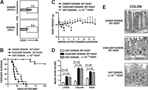 Figure 2. Protection against GVHD after TLI/ATS is dependent on both donor CD4+CD25+ Tregs and host invariant NKT cells. (A) Representative FACS patterns of the donor transplant inoculum before (PRE) and after (POST) CD25+ T-cell depletion. Percentage of CD4+CD25+ T cells among gated CD4+TCRαβ+ T cells is shown enclosed in boxes. (B) Survival of wild-type BALB/c hosts after TLI/ATS conditioning, followed by transplantation of either undepleted (UNDEP DONOR, WT HOST; n = 8) or CD25+ T cell–depleted (CD25-DEP DONOR, WT HOST; n = 9) donor grafts consisting of 50 × 106 bone marrow and 60 × 106 splenocytes from wild-type C57BL/6 donors. Also shown is survival of NKT cell–deficient Jα18−/− (n = 10) hosts conditioned with TLI/ATS and injected with 50 × 106 untreated whole bone marrow and 60 × 106 untreated splenocytes from wild-type C57BL/6 donors (UNT DONOR, Jα18−/− HOST). Each group represents survival combined from 2 to 3 separate experiments. (C) Mean body weight (± SE) of TLI/ATS-conditioned wild-type BALB/c hosts receiving either undepleted or CD25+ T cell–depleted donor grafts or TLI/ATS-conditioned NKT cell–deficient Jα18−/− hosts receiving untreated donor grafts shown in panels A and B, at serial time points after transplantation. + indicates analysis was stopped when 2 hosts remained in the group. (D) Mean (± SE) histopathologic GVHD scores of colon, skin, and liver at day 6 from wild-type (WT) hosts given untreated or CD25-depleted transplants or Jα18−/− hosts given untreated transplants. n = 5 for all groups. (E) Microscopic examination of hematoxylin/eosin-stained sections of colon at day 6 in a representative host from each group shown in panel C. Comparison of WT BALB/c host given TLI/ATS and an undepleted transplant and WT BALB/c host given TLI/ATS and a CD25+ T cell–depleted transplant demonstrates severe crypt apoptosis (→), inflammatory infiltrates (*), and crypt atrophy with loss of goblet cells in the latter compared with the former. NKT cell–deficient Jα18−/− host given TLI/ATS and untreated transplant reveals severe crypt apoptosis (→), inflammatory infiltrates (*), and crypt atrophy with loss of goblet cells. All micrographs are at 300× final magnification.
