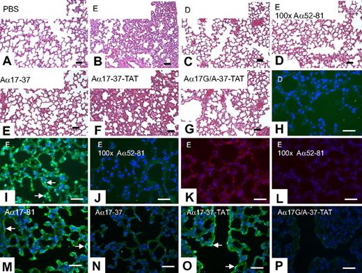 Figure 7. In vivo effects of FDP. (A-G) Lung morphology of mice injected with the indicated reagents; H&E. (H-J, M-P) TUNEL stain to detect in situ DNA-fragmentation on corresponding sections. Green fluorescence indicates TUNEL-positive staining. Nuclear counterstain with Hoechst dye (blue). (K,L) Immunostaining for activated caspase-3 (red). Equivalent loading concentrations of D- and E-fragments estimated from average molecular weight of fragments; synthetic peptides were injected to achieve a loading concentration in blood similar to that of D- and E-fragment (∼2 μM). Arrows denote apoptotic endothelium surrounding presumptive blood vessels filled with erythrocytes (determined by examination of phase contrast images). Bars represent 50 μm.