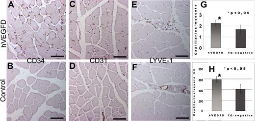 Figure 3. Blood and lymphatic capillary density in TG and control mice as shown by CD34, CD31, and LYVE-1 stainings. Images were taken from immunohistochemically stained 5-μm paraffin sections of mouse tissues and analyzed with Olympus Provis AX70 Microscope attached to Olympus ColorView 12 Camera. The software for imaging and analyses was AnalySIS (Soft Imaging System). (A) Representative figure from a TG mouse showed an increase in capillary density (CD). (B) In comparison, a normal capillary density was present in control mouse (CD34). (C) Representative figure from a TG mouse showed an increase in capillary density (CD31). (D) In comparison a normal capillary density was present in control mouse (CD31). (E) Lymphatic vessels were detected only in the interstitium accompanied by venules and arterioles in TG mice (LYVE-1). (F) Control muscles showed a similar pattern and number of lymphatic vessels (LYVE-1). Bars in panels A through F = 100 μm. (G) Capillaries/myocyte of nonoperated musculus rectus of the hVEGFD TG mice and the TG-negative controls. The mice were from generations F1, F2, and F3. (H) Capillary density in myocardium of the hVEGF-D TG-positive and the TG-negative littermates. The mice were from generations F1, F2, and F3. Error bars represent ± SD.