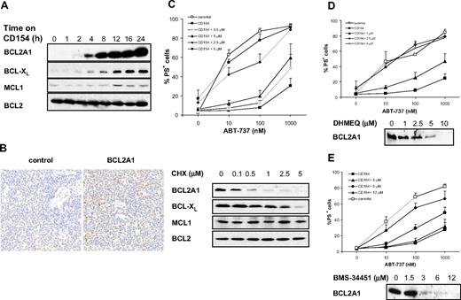 Figure 4. Resistance to ABT-737 correlates with NF-κB–mediated up-regulation of BCL2A1 and BCL-XL. (A) Expression of BCL2 proteins was assessed by Western blotting after 0 to 24 hours of culture on CD154-expressing cells. (B) Expression of BCL2A1 was assessed by immunohistochemistry on lymph node sections from CLL patients. (C) CLL cells were cultured on CD154-expressing cells for 24 hours and simultaneously exposed to different concentrations of cycloheximide (CHX). Apoptosis was assessed by PS externalization and annexin V/FITC binding (top panel, n = 3). Expression of BCL2 proteins was assessed by Western blotting (bottom panel). (D,E) CLL cells were cultured on CD154-expressing cells for 24 hours and simultaneously exposed to different concentrations of DHMEQ (D) or BMS-34451 (E). Apoptosis was assessed by PS externalization and AnnexinV/FITC binding (top panel, n = 3). Expression of BCL2A1 was assessed by Western blotting (bottom panel).