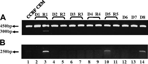 Figure 5. RT-PCR analysis reveals skipping of FPGS exon 12 in RNA from ALL patient specimens. PCR was performed on cDNA prepared from 5 ALL patient specimens at first diagnosis (lanes 2, 4, 6, 8, 10, 12-14) and at relapse (lanes 3, 5, 7, 9, 11), using primer ex9-10 residing in the junction between exons 9 and 10 and primer EX13-dw (A), or ex11-13 residing in the junction between exons 11 and 13 and primer EX15-dw (B). (A) All samples (including CCRF CEM, lane 1) exhibited the expected 450-bp-long product, whereas relapse sample R1 (lane 3) displayed low levels of another 300-bp product. DNA sequencing corroborated the absence of exon 12 in this 300-bp product. (B) This diagnostic PCR results in a 250-bp product only when exon 12 is absent, and was obtained for relapse sample R1 (lane 3) and to a lower extent in 2 diagnosis samples D5 and D8 (lanes 10 and 14, respectively).