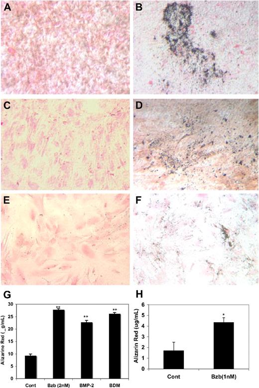 Figure 4. Bzb induces matrix mineralization and calcium secretion by MSCs. C3H10T1/2 (A,B), MSC from normal donors (C,D), and MM patients (E,F) were cultured at 6-well plates for 24 hours at an initial density of 3 × 105/cm2. The cells were cultured in the absence of (A,C,E) or presence of 2 nM Bzb (B,D,F) for 21 days. Matrix mineralization was assessed by von Kossa staining. Stained cultures were photographed at 100× magnification. C3H10T1/2 cells (G) and MSCs from an MM patient (H) were cultured in the absence or presence of Bzb at indicated concentrations for 21 days using BMP-2 (200 ng/mL) or OB differentiation media (BDM) as the positive controls. Calcium staining was assessed by ARS as described. Results are mean plus or minus SD (n = 3). *P < .01, **P < .01, relative to control. An Olympus IMT2 inverted research microscope (Olympus) using an Olympus 40×/0.65 P was used. The fluorescent images were acquired using a SPOT camera (Diagnostic Instruments) Model: 2.21 and were processed with an Advanced STOP version 4.7 software (Diagnostic Instruments) and Adobe Photoshop CS2 version 9.02 software (Adobe Systems).