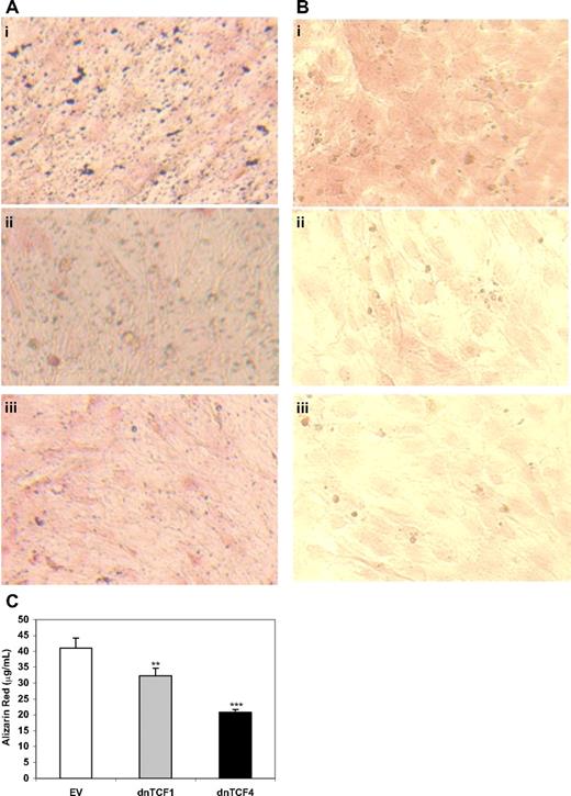 Figure 7. Blocking TCF transcriptional activity attenuates Bzβ-induced matrix mineralization by MSC differentiation. C3H10T1/2 cells seeded in 12-well plates were transfected with 0.5 mg/mL of empty vector (Ai,Bi), dominant negative TCF1 (dnTCF1) (Aii,Bii), or dnTCF4 (Aiii,Biii) plasmid DNA for 48 hours. The cells were cultured in the absence or presence of 1 nM Bzb for 21 days. Matrix mineralization staining (Ai-iii) or calcium staining (Bi-iii) was performed as described in “Matrix mineralization.” (C) Primary MSCs from patients with MM transfected with EV, dnTCF1, or dnTCF4 plasmid DNA were cultured in the presence of 1 nM Bzb for 21 days. Calcium deposition was analyzed by ARS. Results are mean plus or minus SD (n = 3). *P < .01, **P < .001 vs controls. An Olympus IMT2 inverted research microscope (Olympus) using an Olympus 40×/0.65 P was used. The fluorescent images were acquired using a SPOT camera (Diagnostic Instruments) Model: 2.21 and were processed with an Advanced STOP version 4.7 software (Diagnostic Instruments) and Adobe Photoshop CS2 version 9.02 software (Adobe Systems).