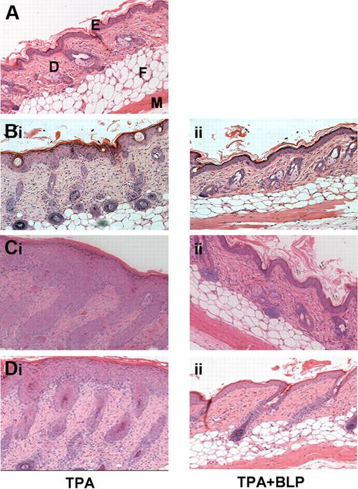 Figure 1. Systemically administered BLP ameliorates cutaneous inflammation. (A) Hematoxylin and eosin (H&E) staining of untreated murine dorsal skin. E, epidermis; D, dermis; F, fatty layer; M, muscle layer. (B) WT mice were given daily intraperitoneal prophylactic doses of either (i) saline or (ii) 100 μg BLP, followed by 3 days of TPA painting to shaved dorsal skin (150 μL of a 50-μmol/L solution in acetone). Two days later mice were culled and skin sections stained by H&E. (C) D6-deficient mice were given daily intraperitoneal prophylactic doses of either (i) saline or (ii) BLP and subjected to TPA painting, as for WT mice. Four days after the TPA painting, mice were culled and skin sections stained by H&E. (D) D6-deficient mice were painted with TPA daily for 3 days and given (i) therapeutic saline or (ii) 100 μg BLP 48 hours after final TPA paint. All results are representative of 3 separate experiments with 5 mice per group per experiment.