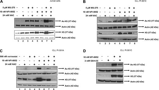 Figure 5. An antioxidant attenuates hyperacetylation of histone-H3 by NPI-0052 and HDACi in cell lines and primary cells. (A) NAC decreases histone-H3 expression and hyperacetylation of histone-H3 in Jurkat cells treated with NPI-0052 and MS-275. Cells were pretreated with 24 mM NAC for 30 minutes followed with 5 μM MS-275, 10 nM NPI-0052, or combination treatment for 6 hours. Cells were harvested, lysed, and analyzed by Western blot analysis for expression of Ac-H3, histone-H3, and actin. (B) Increased histone-H3 expression and hyperacetylation as a result of NPI-0052/MS-275 interaction is decreased by NAC in CLL patient sample. Peripheral blood from patient material (patient no. 1) was separated by centrifugation with a Ficoll gradient. Isolated cells were exposed to indicated doses of NPI-0052 and MS-275 for 6 hours after exposure to 24 mM NAC. Cell lysates were analyzed for Ac-H3, histone-H3, and actin expression by Western blot analysis. (C) Hyperacetylation of histone-H3 and increased histone-H3 expression by NPI-0052/vorinostat in CLL primary cells were attenuated with NAC. Mononuclear cells were isolated from CLL patient peripheral blood (patient no. 2). Cells were treated for 6 hours with 500 nM vorinostat, 10 nM NPI-0052, or a combination after exposure to 24 mM NAC for 30 minutes. Protein lysates were prepared and Western blot analyzed expression for Ac-H3, histone-H3, and actin. (D) Supplementation with glutathione ethyl ester (GSH-EE) reduces hyperacetylation of histone-H3 by NPI-0052 in primary cells. Isolated CLL primary cells (patient no. 3) were pretreated with 2 mM GSH-EE for 1 hour, followed by exposure to 10 nM NPI-0052 or diluent for 6 hours. Protein lysates were prepared and analyzed by Western blot analysis for Ac-H3, histone-H3, and actin expression.