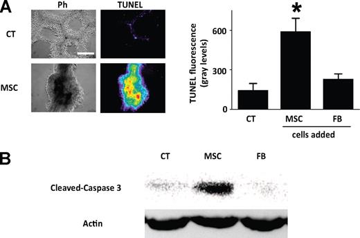 Figure 2. MSC-induced apoptosis of EC-derived capillaries in matrigel. (A) Images are phase contrast (Ph) and TUNEL fluorescence in 4-day-old capillary cultures to which no cells were added (CT), or MSCs were added after 1 day of culture at 1:1 ratio to EC (MSC). Bar = 500 μm. Bar diagram shows corresponding group data. FB, at EC:RNLFB ratio of 1:1. Data are mean plus or minus SD; n = 3 for each group. *P < .05, significantly different from CT. (B) Immunoblot for cleaved caspase-3 in 4-day-old capillaries exposed to no cells (CT), MSC, or FB as above. Actin expression is shown in the bottom panel. Replicated 3 times.