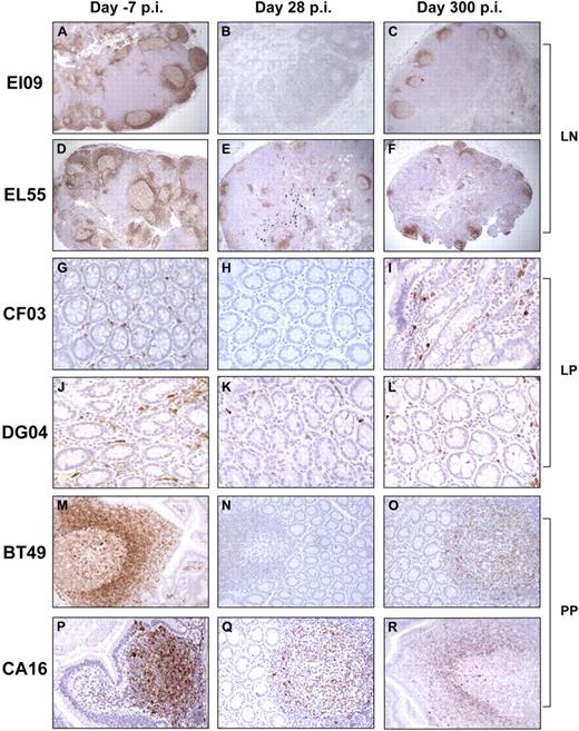 Figure 2. Effect of rituximab infusion on the frequencies of CD79a+ B cells in tissues. Panels A through F demonstrate the rituximab effect on LN CD79a+ B cells in a RM with complete B-cell depletion in tissues (A-C) versus a RM with incomplete B-cell depletion in tissues (D-F). LNs were collected before (day −7 pi; A,D) at 28 days pi (B,E) and at day 300 pi (C,F). Panels G through R demonstrate the rituximab effect on intestinal CD79a+ B cells from both lamina propria (LP; G-L) and Peyer patches (PP; M-R). Slides were examined with a Leica DMLB microscope (Leica Microsystems, Wetzlar, Germany) using the following objective lenses and numeric apertures: N PLAN 5×/0.12 (panels A-F); N PLAN 10×/0.25 (panels M-R); and N PLAN 20×/0.4 (panels G-L). Images were acquired with Spot Insight color 3.2.0 software (Diagnostic Instruments, Sterling Heights, MI) and processed with Adobe Photoshop Elements version 3.0 (Adobe Systems, San Jose, CA).