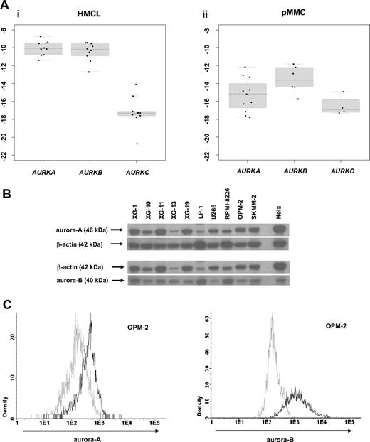 Figure 2. Validation of gene expression by quantitative real-time PCR, Western blotting, and flow cytometry. To validate gene expression data, quantitative real-time PCR for aurora-A, -B, -C in (Ai) 10 human myeloma cell lines (HMCLs) and (Aii) 10 primary multiple myeloma cell samples (pMMCs) was performed. Shown are -dCt values (reference gene 18S-RNA). (B) Gene expression data were further validated by Western blotting. Shown are the blots of 10 cell lines for aurora-A and -B with β-actin as a loading control and HELA cells as a positive control. (C) Intracytoplasmatic expression of aurora-A and -B as determined by flow cytometry. Shown is the cell line OPM-2. The light gray line indicates control without primary antibody; the black line, measurement with primary and secondary antibody.