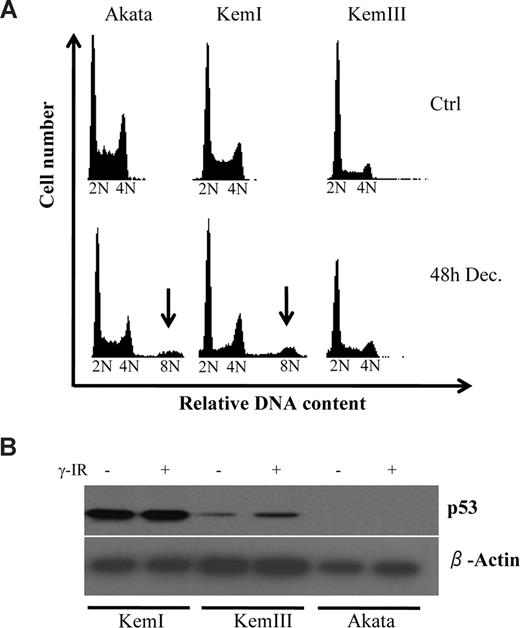 Figure 1. Decitabine induces aneuploidy in p53 deficient Burkitt lymphoma (BL) cells. (A) The BL cell lines Akata, KemI, and KemIII were treated with 2 μM decitabine (Dec) for 48 hours. The cell-cycle distribution was determined by flow cytometry of cells stained with propidium iodide. Cells regarded as aneuploid are indicated by arrows. (B) TP53 status correlates with presence of decitabine-induced aneuploidy of BL cells. Cells were irradiated with 10 Gy of ionizing radiation (γ-IR) and harvested 24 hours after treatment for analysis with Western blot using a monoclonal antibody against p53. The KemI cell line exhibits abnormally high levels of p53 irrespective of DNA damage, which is indicative of a TP53 mutant status. KemIII cells induce p53 after γ-IR treatment, as predicted by cells carrying wild-type TP53. Akata cells do not express p53, as previously shown.32